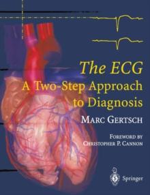 The ECG : A Two-Step Approach to Diagnosis