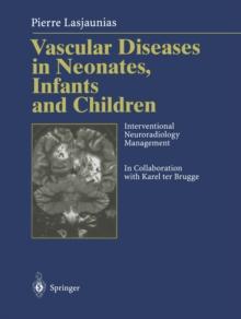 Vascular Diseases in Neonates, Infants and Children : Interventional Neuroradiology Management