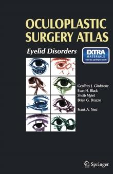 Oculoplastic Surgery Atlas : Eyelid Disorders