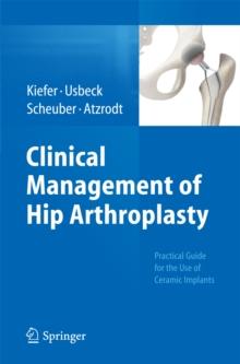 Clinical Management of Hip Arthroplasty : Practical Guide for the Use of Ceramic Implants