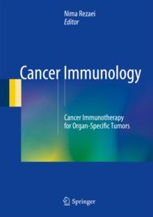 Cancer Immunology : Cancer Immunotherapy for Organ-Specific Tumors