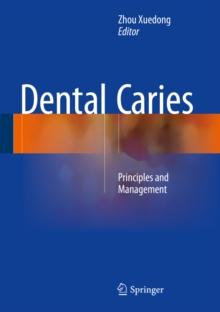 Dental Caries : Principles and Management