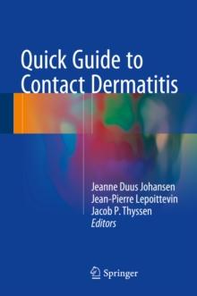 Quick Guide to Contact Dermatitis