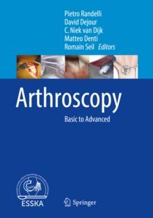 Arthroscopy : Basic to Advanced