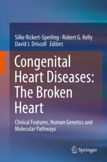 Congenital Heart Diseases: The Broken Heart : Clinical Features, Human Genetics and Molecular Pathways