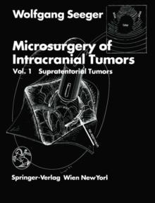 Microsurgery of Intracranial Tumors : Vol 1: Supratentorial Tumors