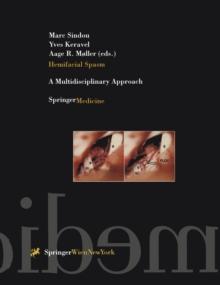 Hemifacial Spasm : A Multidisciplinary Approach