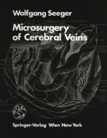 Microsurgery of Cerebral Veins