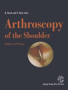 Arthroscopy of the Shoulder : Diagnosis and Therapy