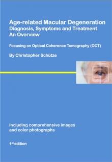 Age-related macular degeneration : Diagnosis, symptoms and treatment, an overview