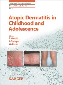 Atopic Dermatitis in Childhood and Adolescence