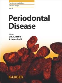 Periodontal Disease