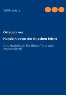 Osteoporose : Handeln bevor der Knochen bricht