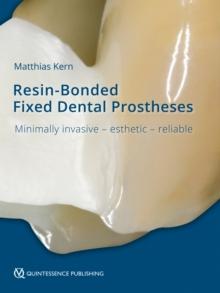 Resin-Bonded Fixed Dental Prostheses : Minimally invasive - esthetic - reliable