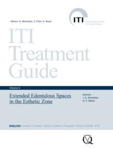 Extended Edentulous Spaces in the Esthetic Zone