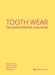 Tooth Wear : The Quintessential Challenge