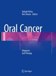 Oral Cancer : Diagnosis and Therapy