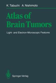 Atlas of Brain Tumors : Light- and Electron-Microscopic Features