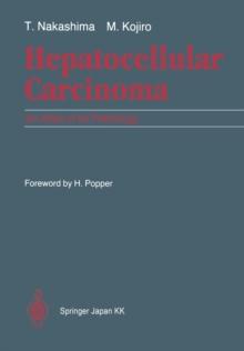 Hepatocellular Carcinoma : An Atlas of Its Pathology