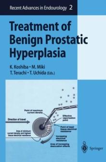 Treatment of Benign Prostatic Hyperplasia