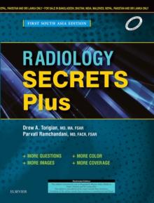 Radiology Secrets: First South Asia Edition - Ebook