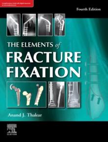 The elements of fracture fixation, 4e