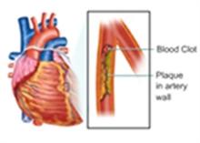 Estimation of Blood Triglycerides