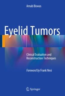 Eyelid Tumors : Clinical Evaluation and Reconstruction Techniques