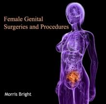 Female Genital Surgeries and Procedures