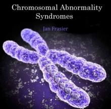 Chromosomal Abnormality Syndromes