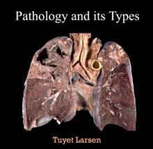 Pathology and its Types