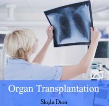 Organ Transplantation