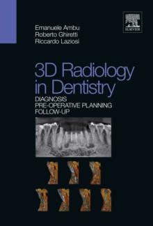 3D Radiology in Dentistry : Diagnosis Pre-operative Planning Follow-up