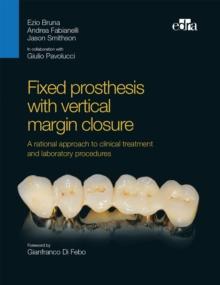 Fixed prosthesis with vertical margin closure : Integration between function and aesthetics