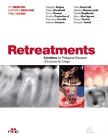 Retreatments : Solutions for apical diseases of endodontic origin