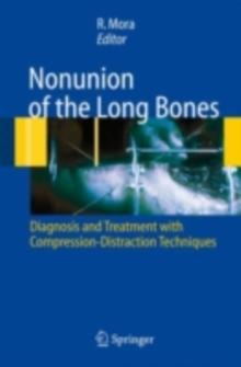 Nonunion of the Long Bones : Diagnosis and treatment with compression-distraction techniques