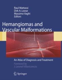 Hemangiomas and Vascular Malformations : An Atlas of Diagnosis and Treatment