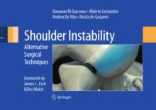 Shoulder Instability : Alternative Surgical Techniques