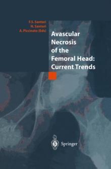 Avascular Necrosis of the Femoral Head: Current Trends : Current Trends