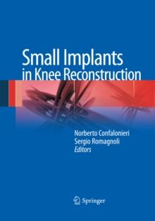 Small Implants in Knee Reconstruction