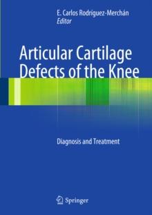 Articular Cartilage Defects of the Knee : Diagnosis and Treatment