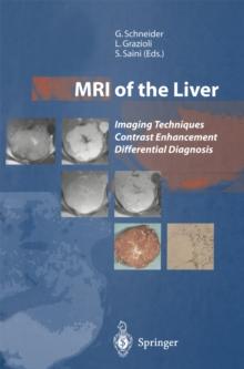 MRI of the Liver : Imaging Techniques Contrast Enhancement Differential Diagnosis