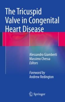 The Tricuspid Valve in Congenital Heart Disease