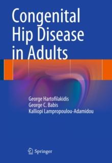 Congenital Hip Disease in Adults