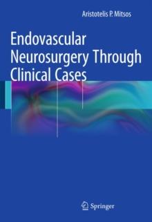 Endovascular Neurosurgery Through Clinical Cases