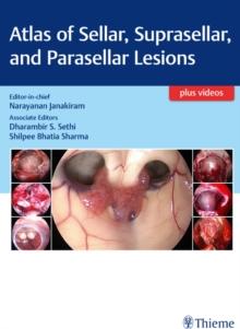 Atlas of Sellar, Suprasellar, and Parasellar Lesions