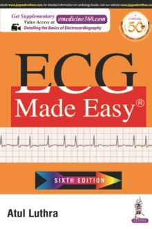 ECG Made Easy