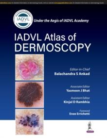 Atlas of Dermoscopy