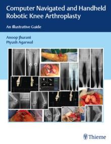 Computer Navigated and Handheld Robotic Knee Arthroplasty : An Illustrative Guide