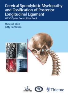 Cervical Spondylotic Myelopathy and Ossification of Posterior Longitudinal Ligament : WFNS Spine Committee Book